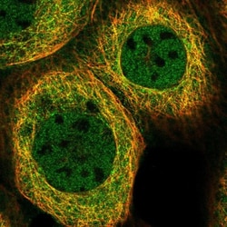 Absent in melanoma 1 Antibody, Novus Biologicals:Antibodies:Primary Antibodies
